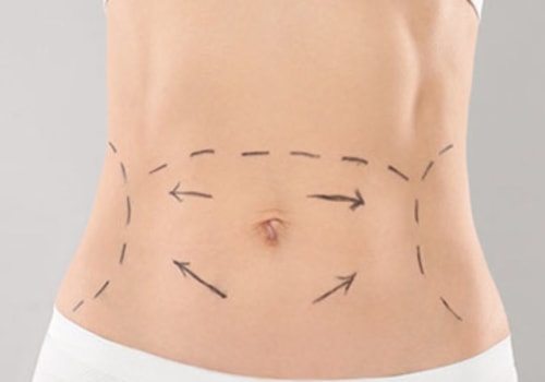 What are the long term effects of coolsculpting?