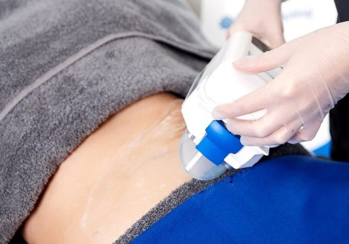 How many coolsculpting is needed?