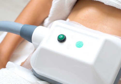 Does coolsculpting remove fat forever?